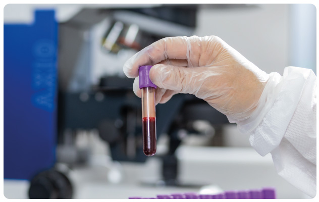 servicio-hematologia